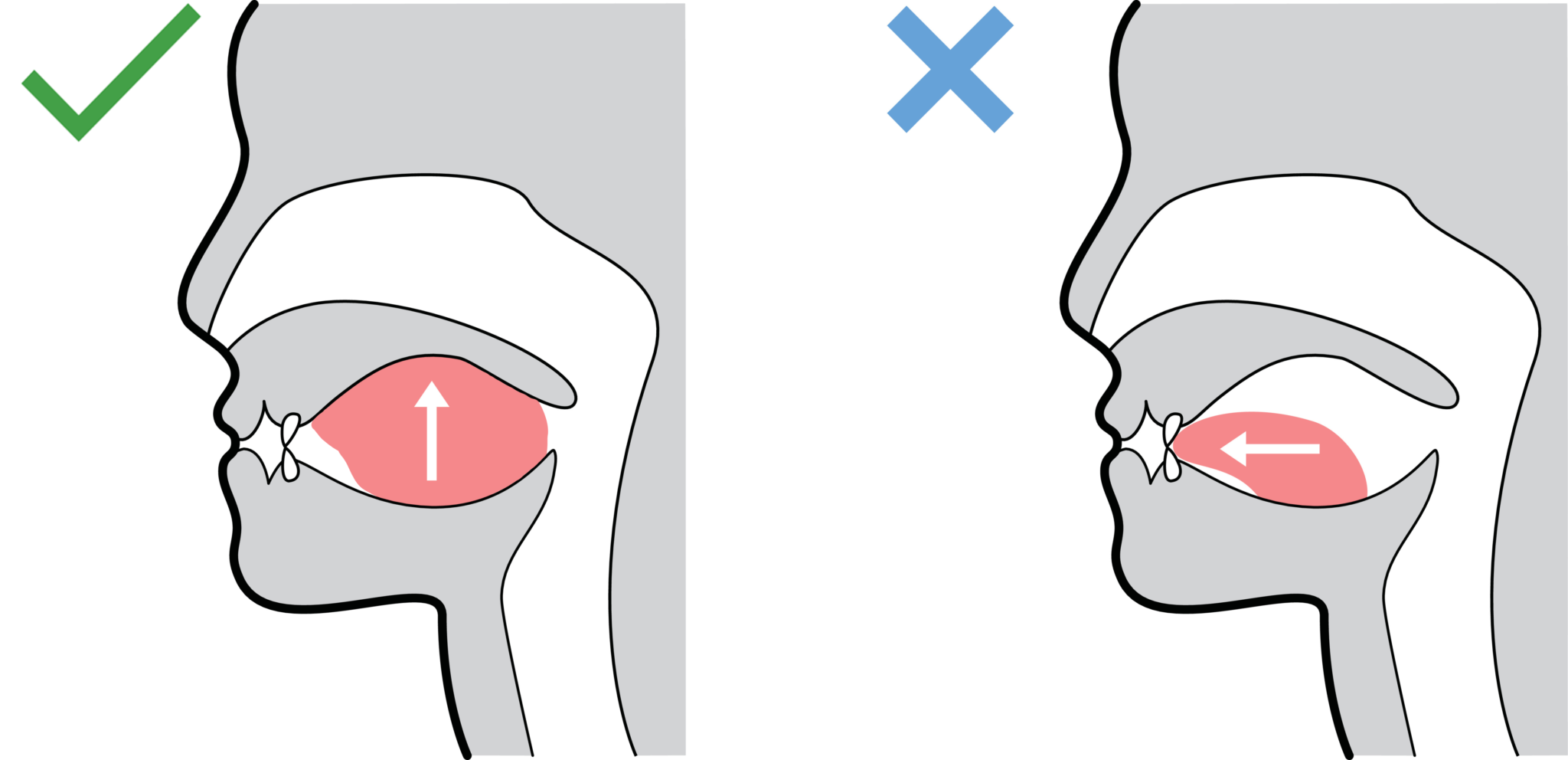 tongue-posture-diagram-edited-2048x992.png