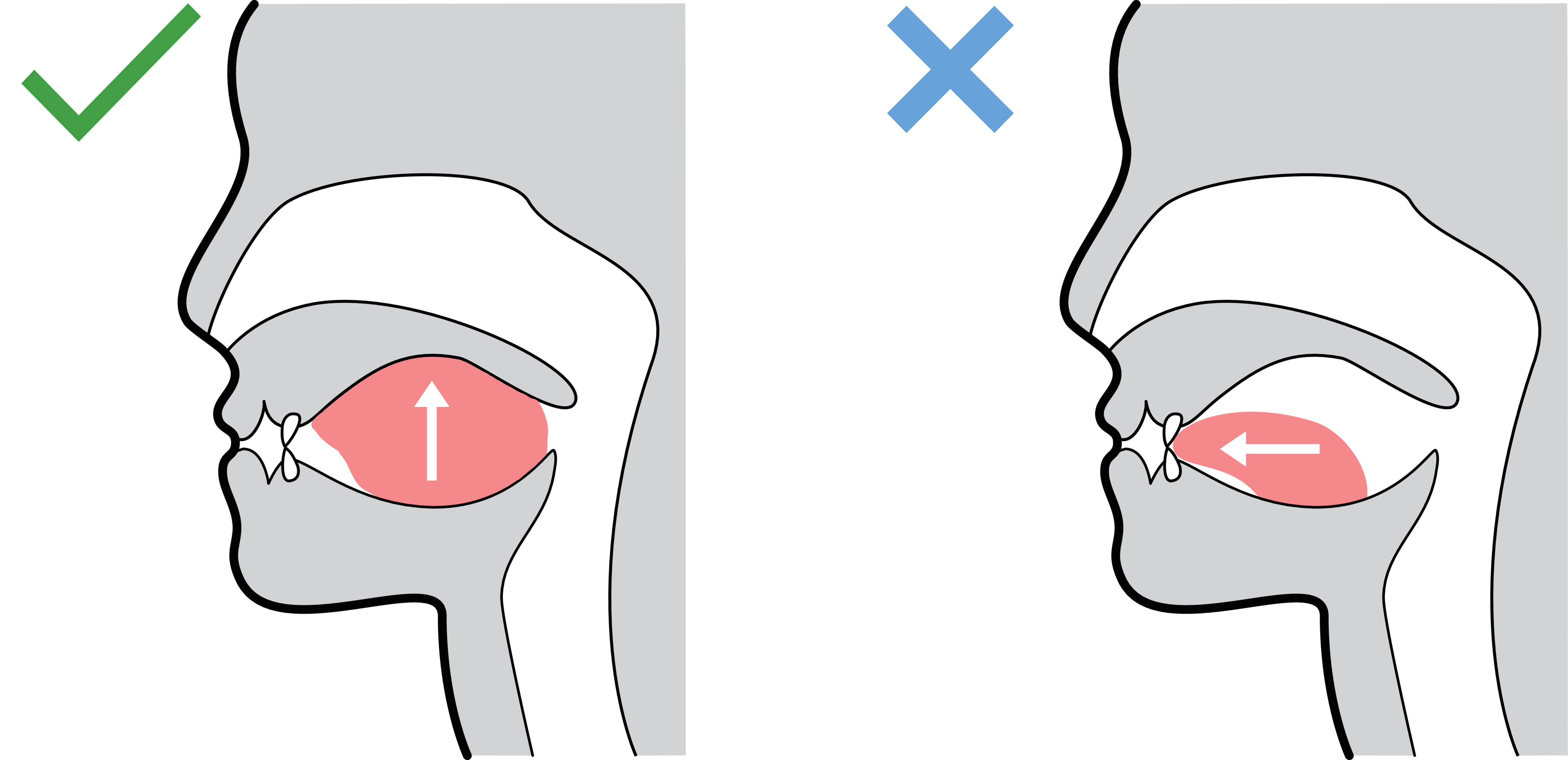 Tongue Posture Diagram Edited 