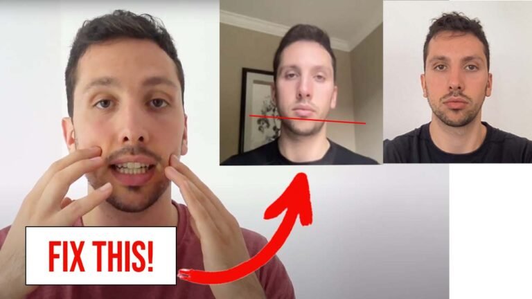 How to Mew Evenly: Fixing Asymmetry Caused by Imbalanced Tongue Function