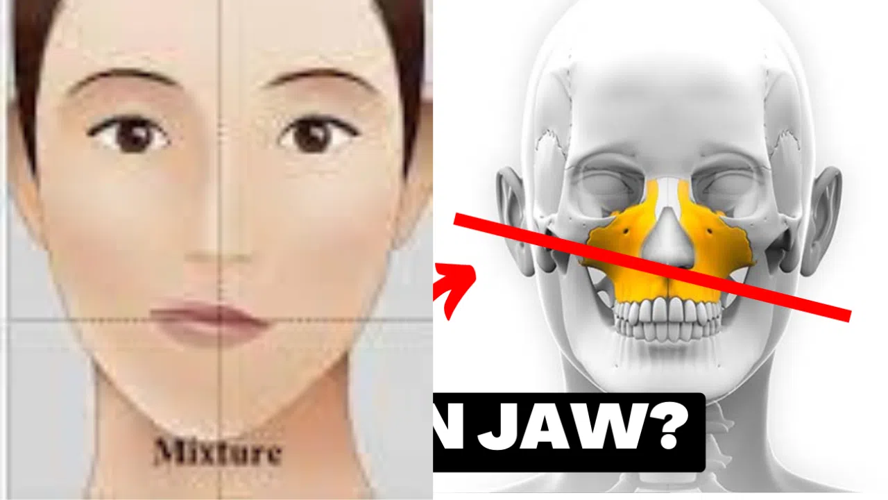 Uneven jaw?