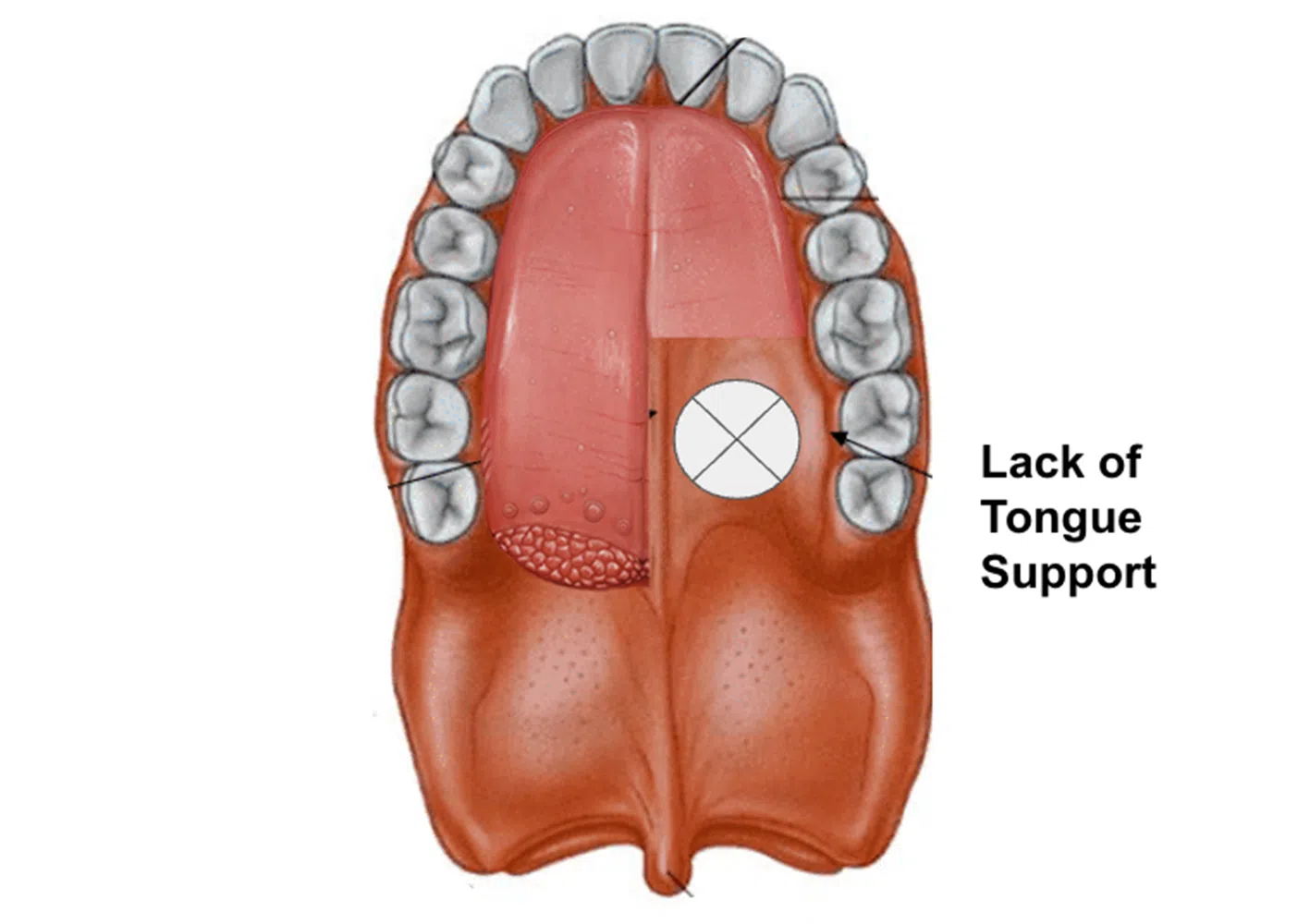 Uneven-Tongue-website-photo-1